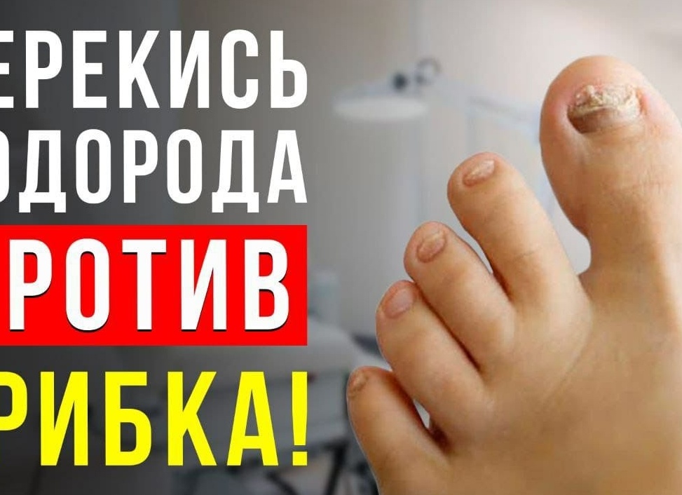 Перекись водорода от грибка ногтей — лучшие рецепты, реальные отзывы