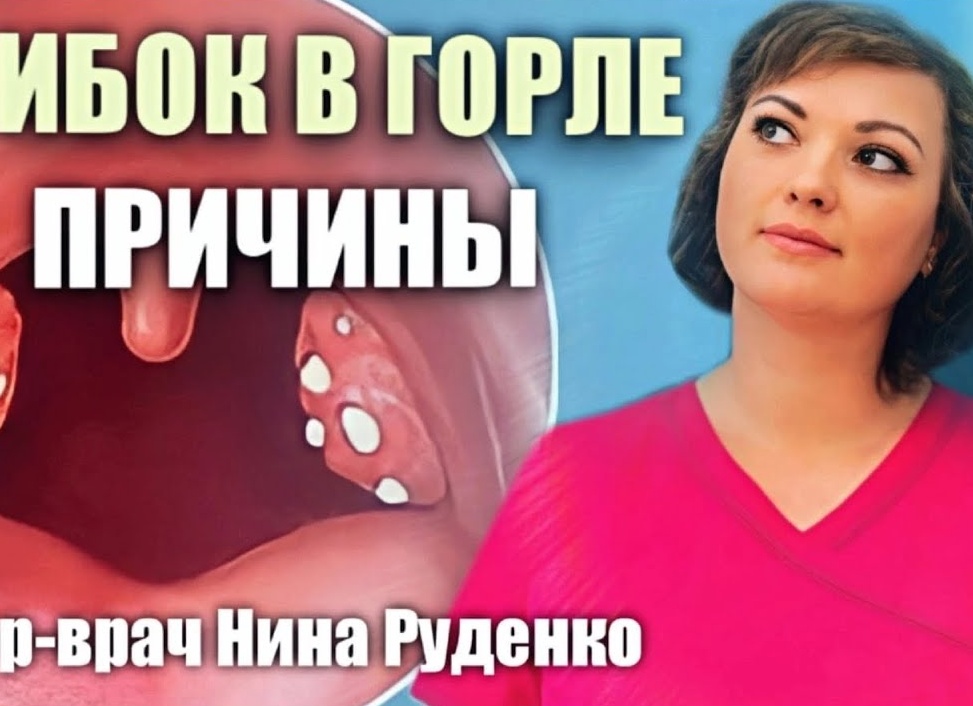 Грибки в горле у ребенка: как их распознать?