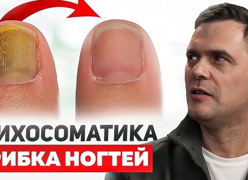 Психосоматика микоза кожи: когда грибок говорит за нас