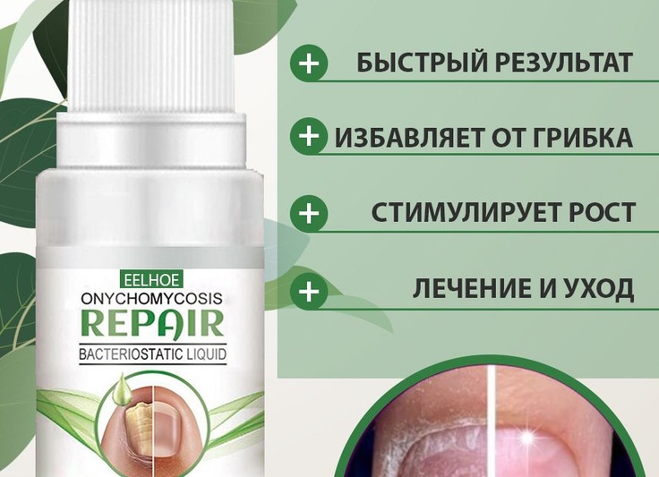 Грибок ногтей на руках. Профилактика и как лечить