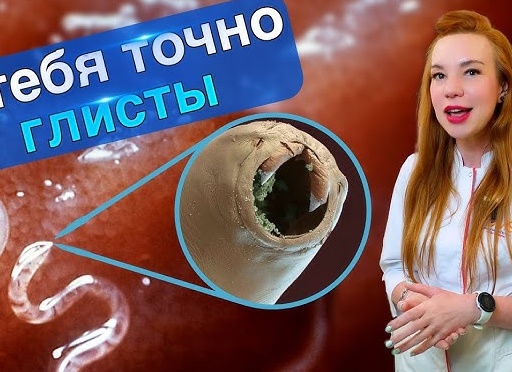 9 признаков заражения разными видами глистов у взрослых. Как распознать у себя глистную инвазию (как можно раньше)