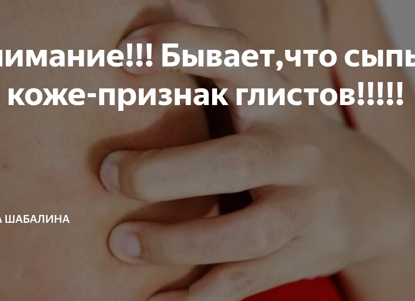 Внимание!!! Бывает,что сыпь на коже-признак глистов!!!!!