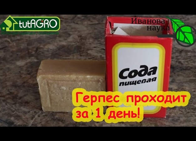 Герпес и как от него избавиться