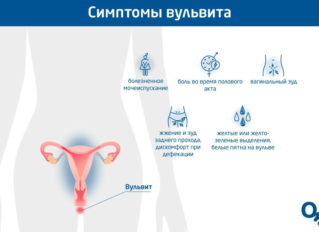 Зуд и жжение у женщин