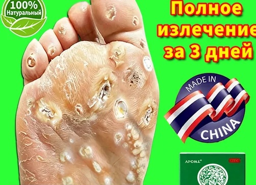 Волшебный пластырь Салипод