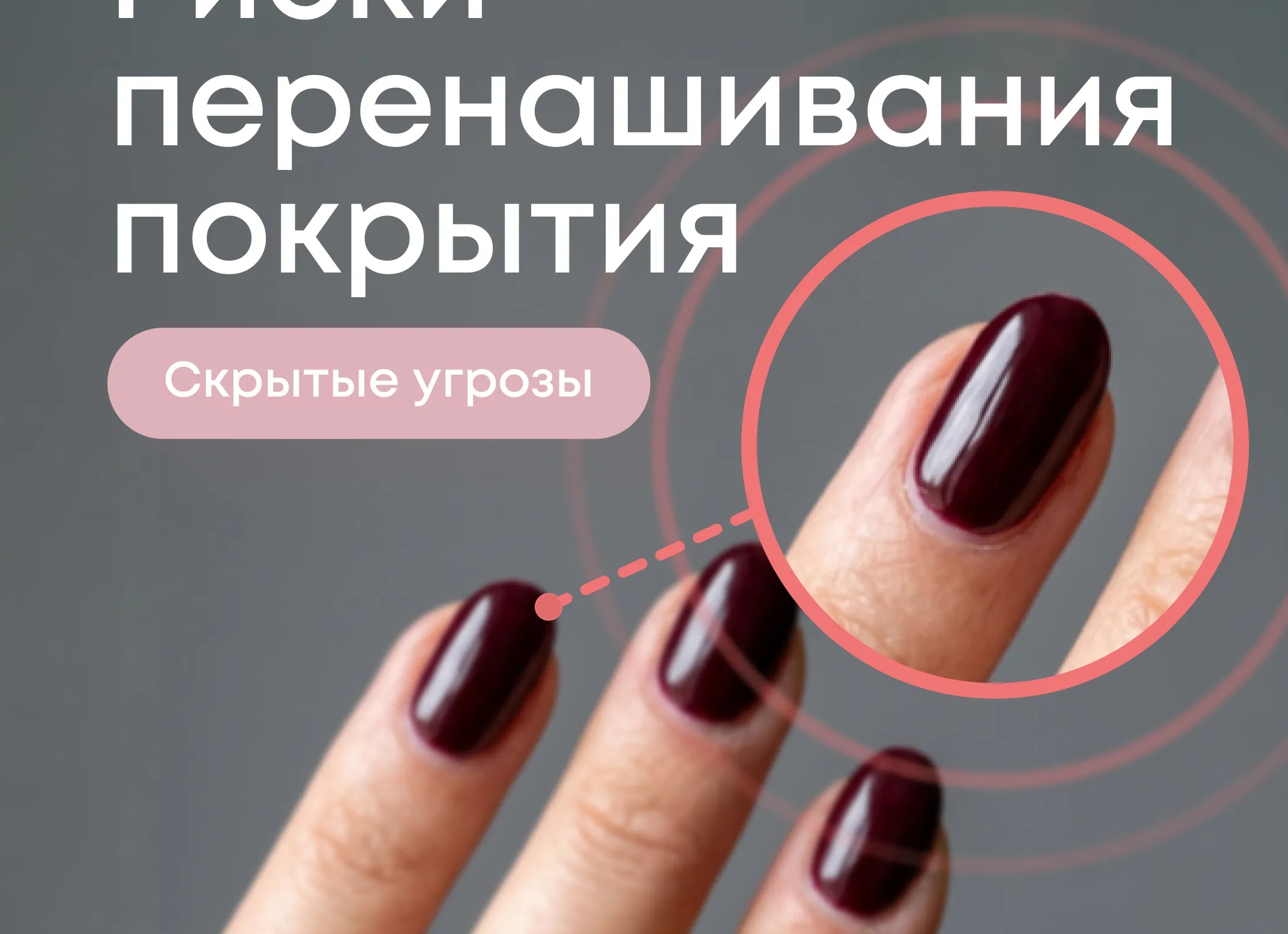 Грибок ногтей: скрытая опасность и как распознать врага на ранней стадии