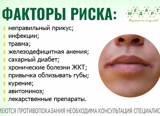 Почему трескаются уголки губ