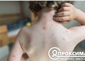 Грибок в организме - причина всех болезней?