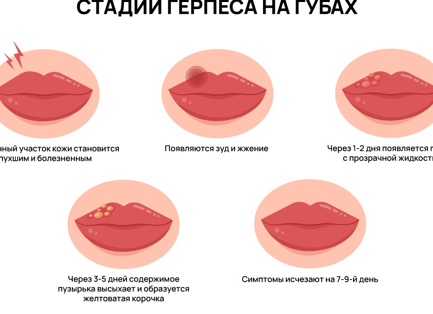 Чем опасен герпес для здоровья человека?