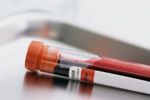 Indicații ale testelor de sânge Alt și ast pentru efectuarea Nivel crescut de ast în sânge