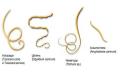 Защо червеите са опасни и как да избегнем инфекция Ефектът на червеите върху нервната система