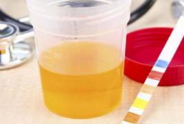 Ce teste de urină există - tipuri de studii, norme