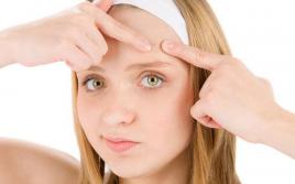 Kādas pūtītes ārstēšanas metodes uz sejas ir labākas un efektīvākas?