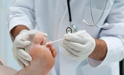 Как определить грибок на ногах: признаки, симптомы, профилактика