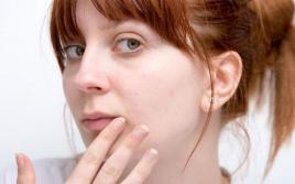 Ce cauzează herpesul pe buze: cauze, prevenire, caracteristici de tratament